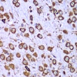 Immunohistochemistry - Anti-RPS10 Antibody (A88633) - Antibodies.com