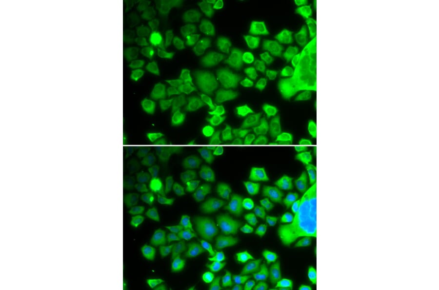 Immunofluorescence - Anti-RPS10 Antibody (A88633) - Antibodies.com