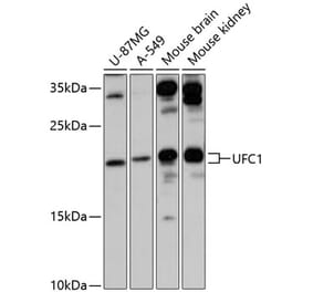 Western Blot - Anti-UFC1 Antibody (A88634) - Antibodies.com