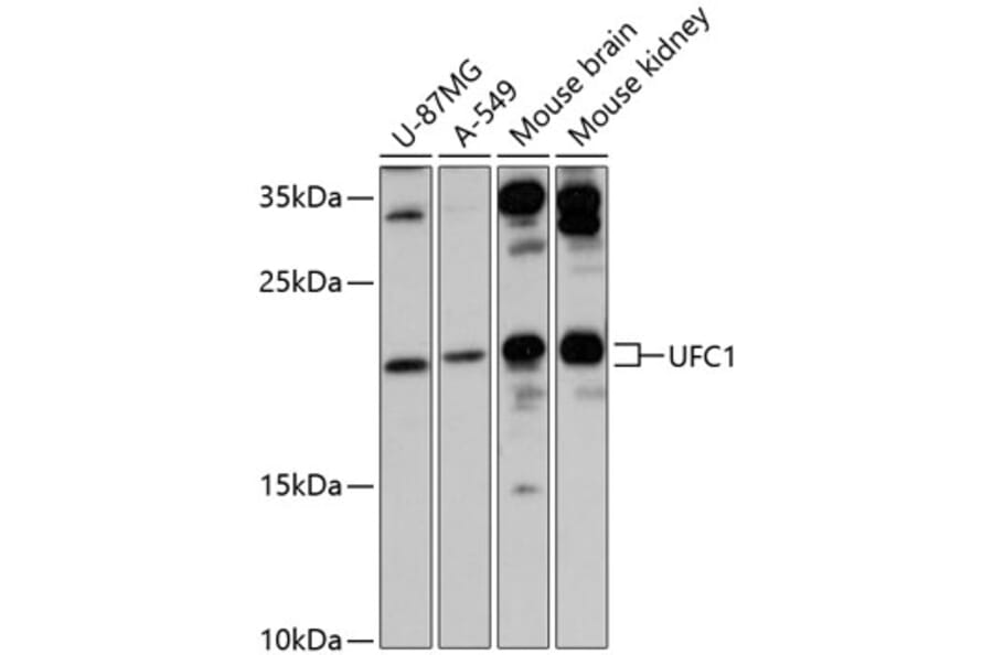 Western Blot - Anti-UFC1 Antibody (A88634) - Antibodies.com