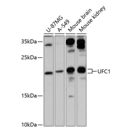 Western Blot - Anti-UFC1 Antibody (A88634) - Antibodies.com