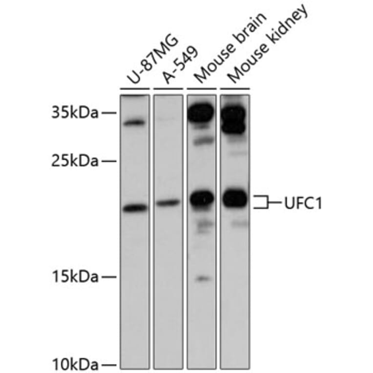 Western Blot - Anti-UFC1 Antibody (A88634) - Antibodies.com