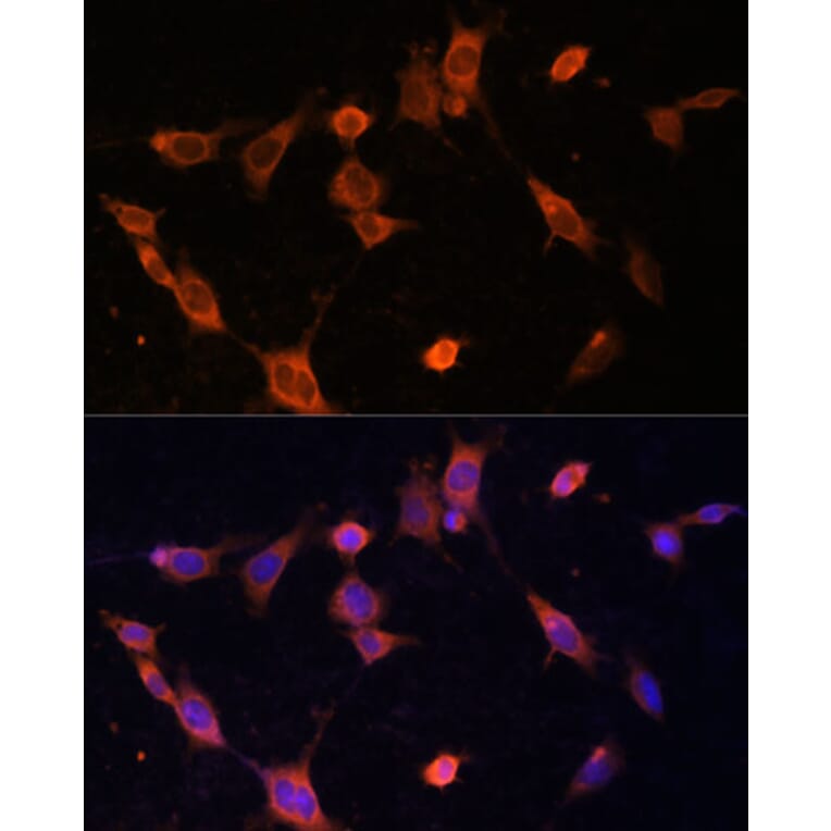 Immunofluorescence - Anti-UFC1 Antibody (A88634) - Antibodies.com