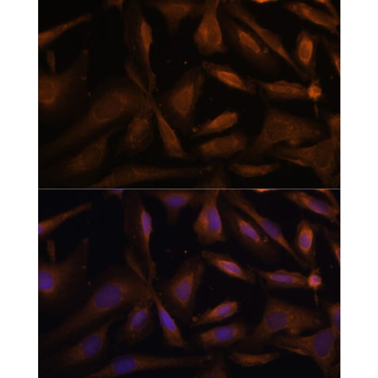 Immunofluorescence - Anti-UFC1 Antibody (A88634) - Antibodies.com