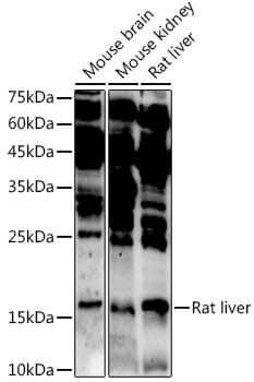 Western blot analysis of extracts of various cell lines, using Anti-ASCL4 Antibody (A14439) at 1:1,000 dilution.
Secondary antibody: Goat Anti-Rabbit IgG (H+L) (HRP) (AS014) at 1:10,000 dilution.
Lysates / proteins: 25µg per lane.
Blocking buffer: 3% non-fat dry milk in TBST.
Detection: ECL Enhanced Kit (RM00021).
Exposure time: 5s.
