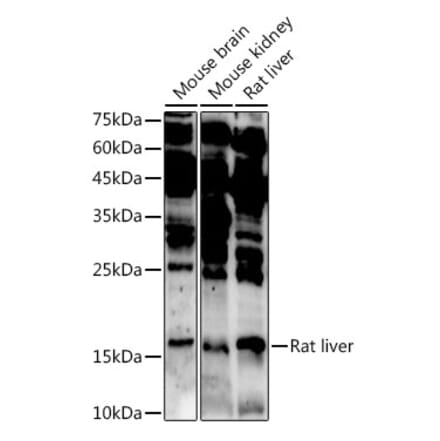 Western Blot - Anti-ASCL4 Antibody (A88635) - Antibodies.com