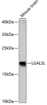 Western blot analysis of extracts of mouse brain, using Anti-LGALSL Antibody (A14880) at 1:1,000 dilution.
Secondary antibody: Goat Anti-Rabbit IgG (H+L) (HRP) (AS014) at 1:10,000 dilution.
Lysates / proteins: 25µg per lane.
Blocking buffer: 3% non-fat dry milk in TBST.
Detection: ECL Basic Kit (RM00020).
Exposure time: 10s.