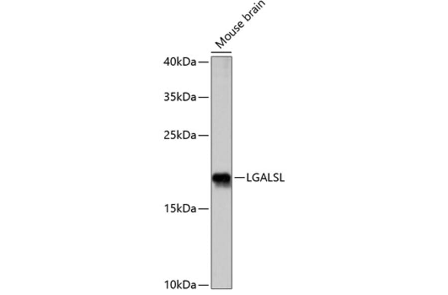 Western Blot - Anti-GRP Antibody (A88636) - Antibodies.com