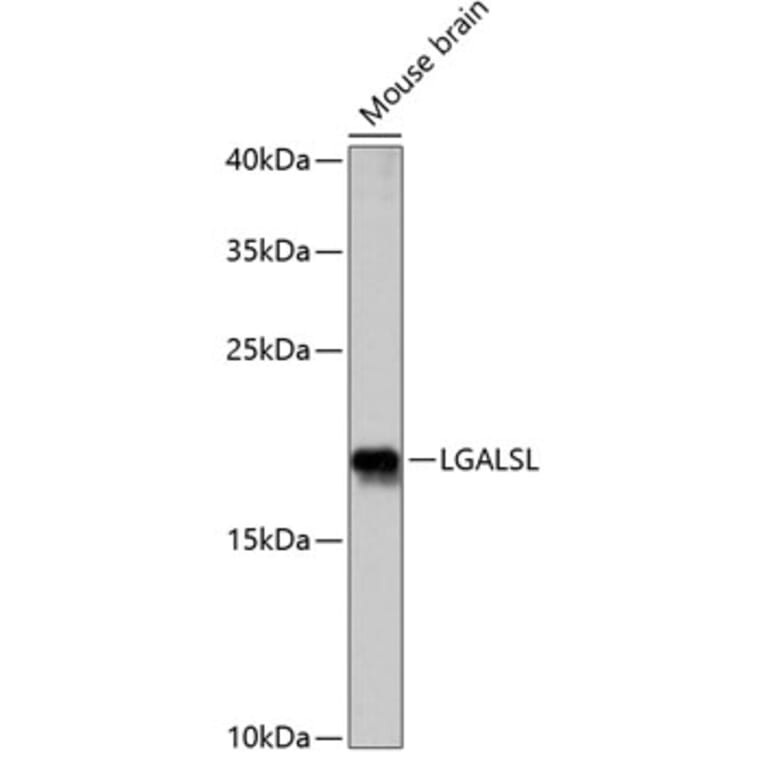 Western Blot - Anti-GRP Antibody (A88636) - Antibodies.com