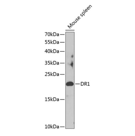 Western Blot - Anti-DR1 Antibody (A88637) - Antibodies.com