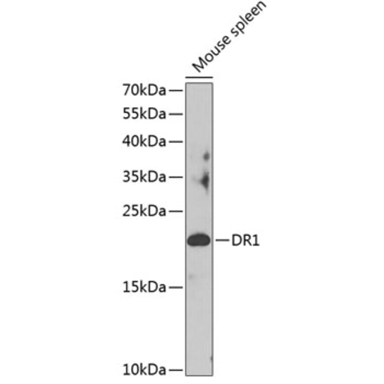 Western Blot - Anti-DR1 Antibody (A88637) - Antibodies.com