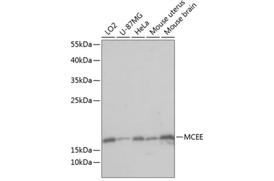 Western Blot - Anti-MCEE Antibody (A88638) - Antibodies.com