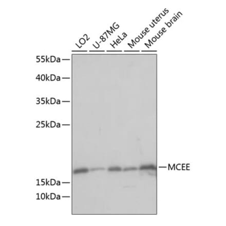 Western Blot - Anti-MCEE Antibody (A88638) - Antibodies.com