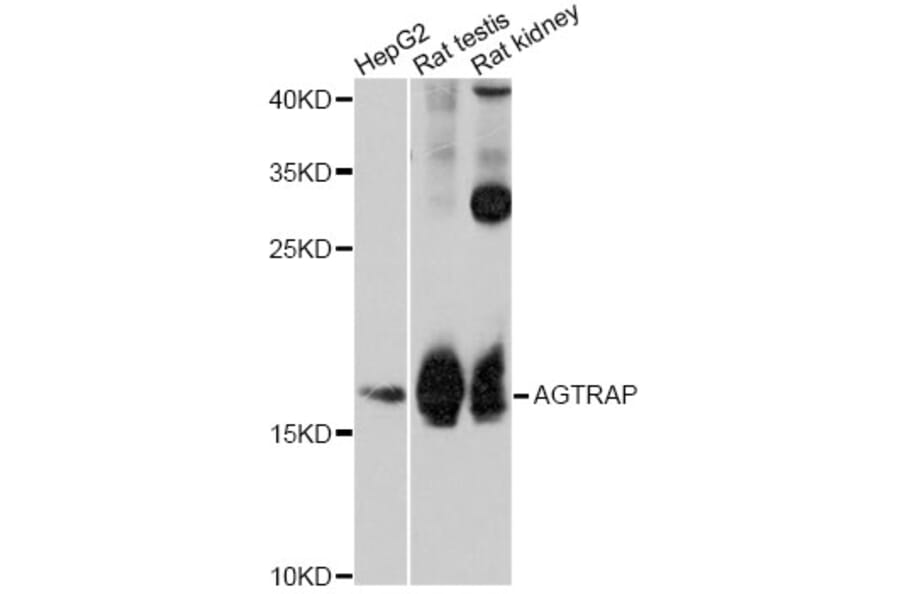 Western Blot - Anti-PPIH Antibody (A12274) - Antibodies.com