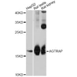 Western Blot - Anti-PPIH Antibody (A12274) - Antibodies.com
