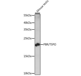 Western Blot - Anti-PBR Antibody (A88640) - Antibodies.com