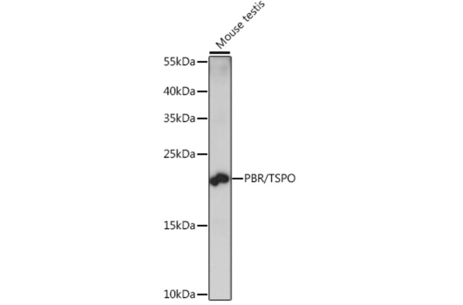 Western Blot - Anti-PBR Antibody (A88640) - Antibodies.com