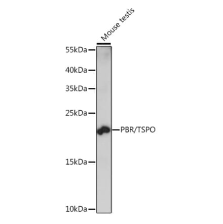 Western Blot - Anti-PBR Antibody (A88640) - Antibodies.com
