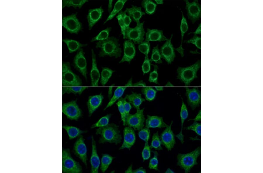 Immunofluorescence - Anti-PBR Antibody (A88640) - Antibodies.com