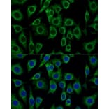 Immunofluorescence - Anti-PBR Antibody (A88640) - Antibodies.com