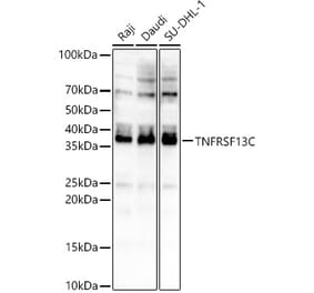 Western Blot - Anti-BAFF-R Antibody (A88642) - Antibodies.com