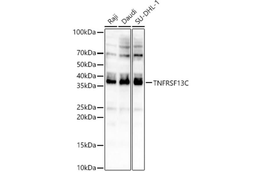 Western Blot - Anti-BAFF-R Antibody (A88642) - Antibodies.com