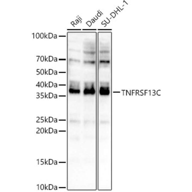 Western Blot - Anti-BAFF-R Antibody (A88642) - Antibodies.com