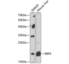 Western Blot - Anti-RBP4 Antibody (A88643) - Antibodies.com