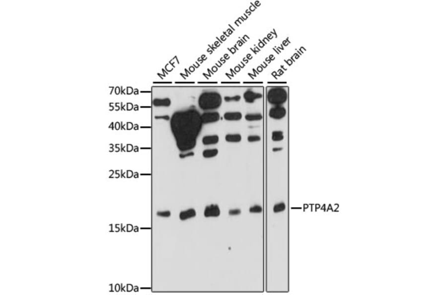 Western Blot - Anti-PTP4A2/PRL2 Antibody (A88644) - Antibodies.com