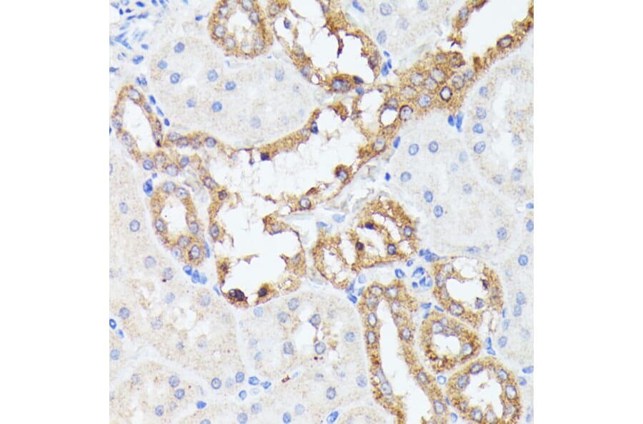 Immunohistochemistry - Anti-PTP4A2/PRL2 Antibody (A88644) - Antibodies.com