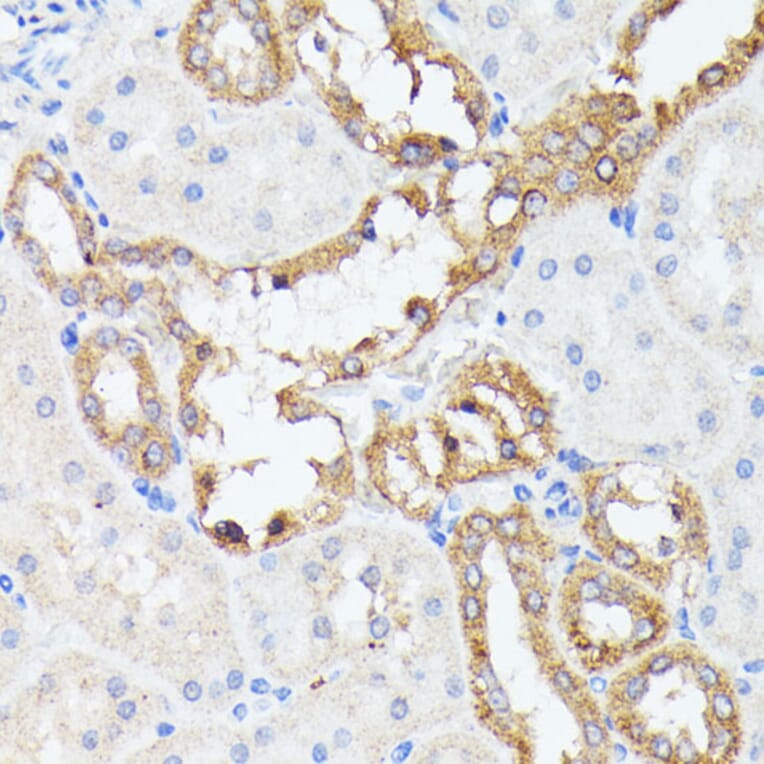 Immunohistochemistry - Anti-PTP4A2/PRL2 Antibody (A88644) - Antibodies.com