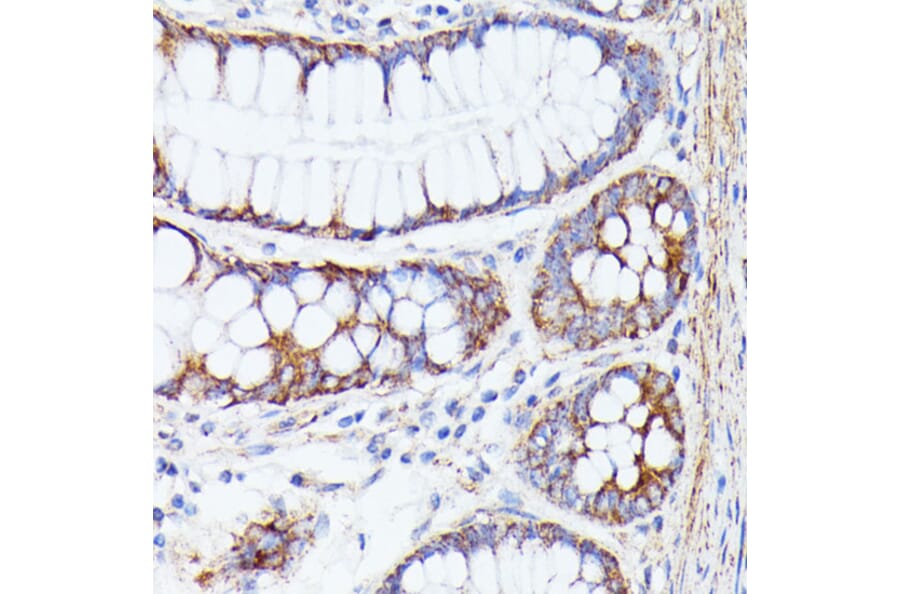 Immunohistochemistry - Anti-PTP4A2/PRL2 Antibody (A88644) - Antibodies.com
