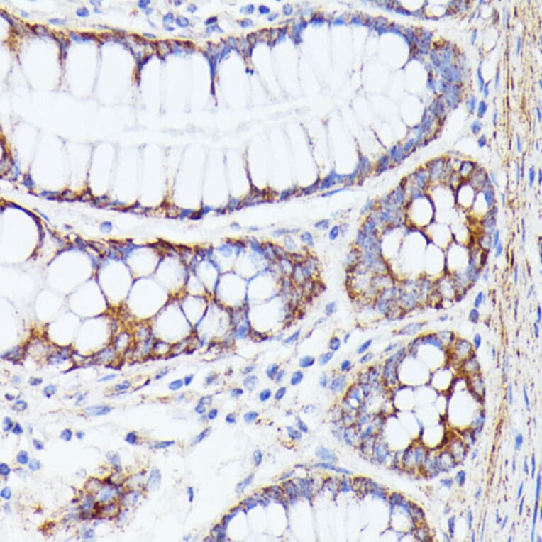 Immunohistochemistry - Anti-PTP4A2/PRL2 Antibody (A88644) - Antibodies.com