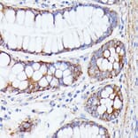 Immunohistochemistry - Anti-PTP4A2/PRL2 Antibody (A88644) - Antibodies.com
