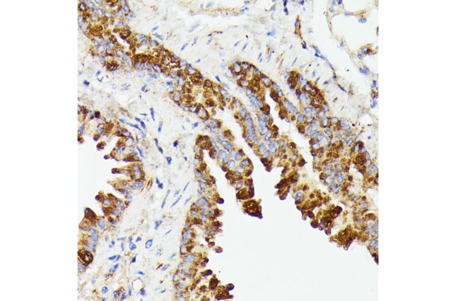 Immunohistochemistry - Anti-PTP4A2/PRL2 Antibody (A88644) - Antibodies.com