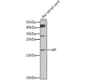 Western Blot - Anti-VIP Antibody (A88645) - Antibodies.com