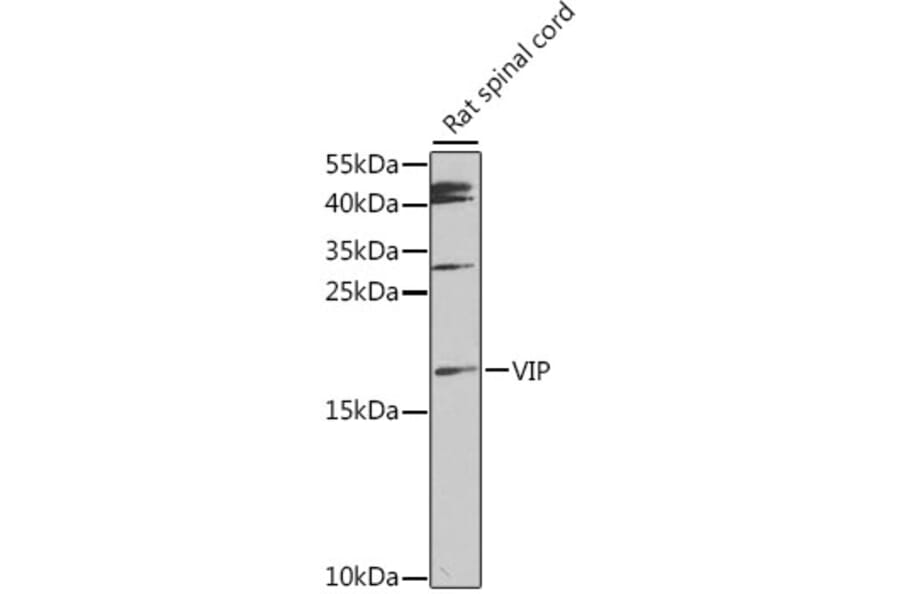 Western Blot - Anti-VIP Antibody (A88645) - Antibodies.com
