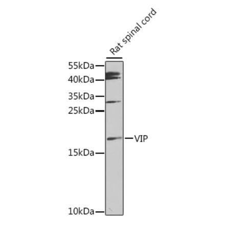 Western Blot - Anti-VIP Antibody (A88645) - Antibodies.com