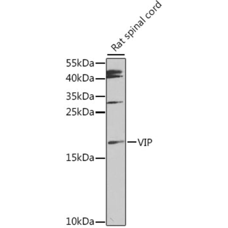 Western Blot - Anti-VIP Antibody (A88645) - Antibodies.com