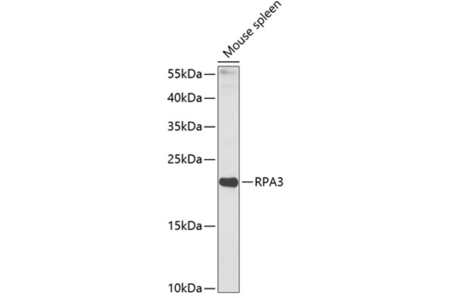 Western Blot - Anti-RPA14/RPA3 Antibody (A88646) - Antibodies.com