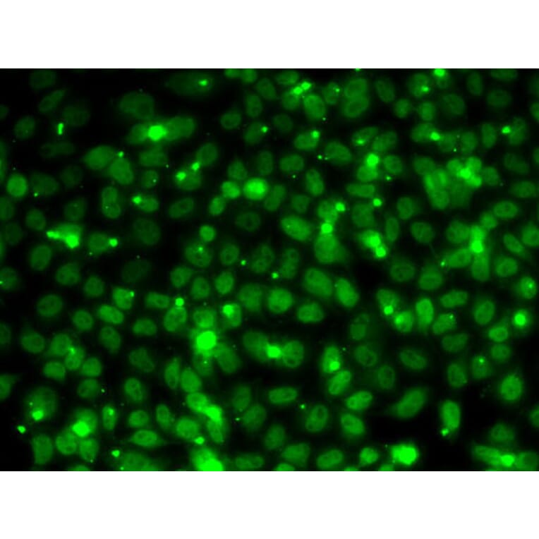 Immunofluorescence - Anti-RPA14/RPA3 Antibody (A88646) - Antibodies.com