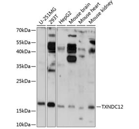 Western Blot - Anti-ERp18 Antibody (A88647) - Antibodies.com