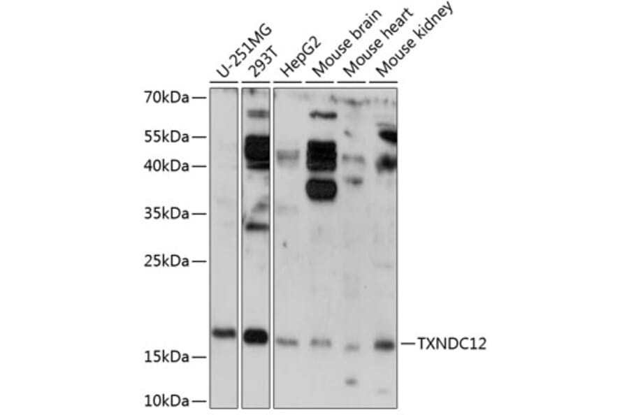 Western Blot - Anti-ERp18 Antibody (A88647) - Antibodies.com
