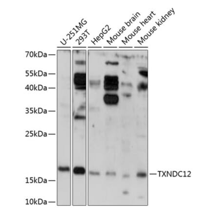 Western Blot - Anti-ERp18 Antibody (A88647) - Antibodies.com
