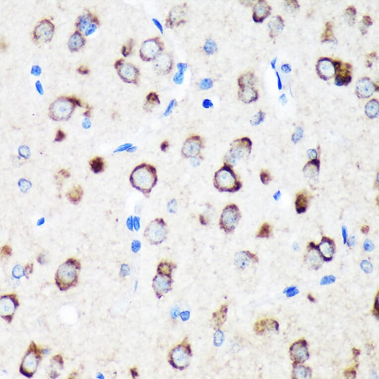 Immunohistochemistry - Anti-ERp18 Antibody (A88647) - Antibodies.com
