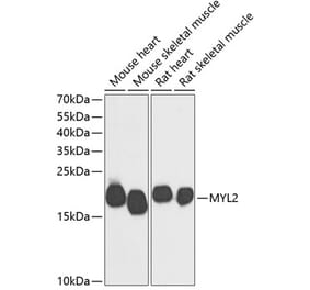 Western Blot - Anti-Myosin Light Chain 2 Antibody (A88648) - Antibodies.com