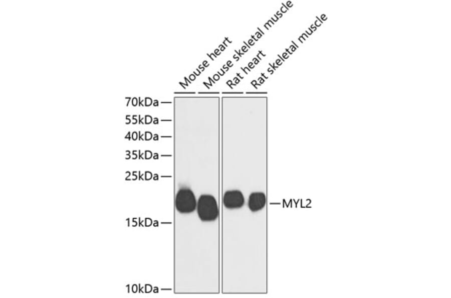 Western Blot - Anti-Myosin Light Chain 2 Antibody (A88648) - Antibodies.com