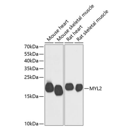Western Blot - Anti-Myosin Light Chain 2 Antibody (A88648) - Antibodies.com