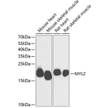 Western Blot - Anti-Myosin Light Chain 2 Antibody (A88648) - Antibodies.com