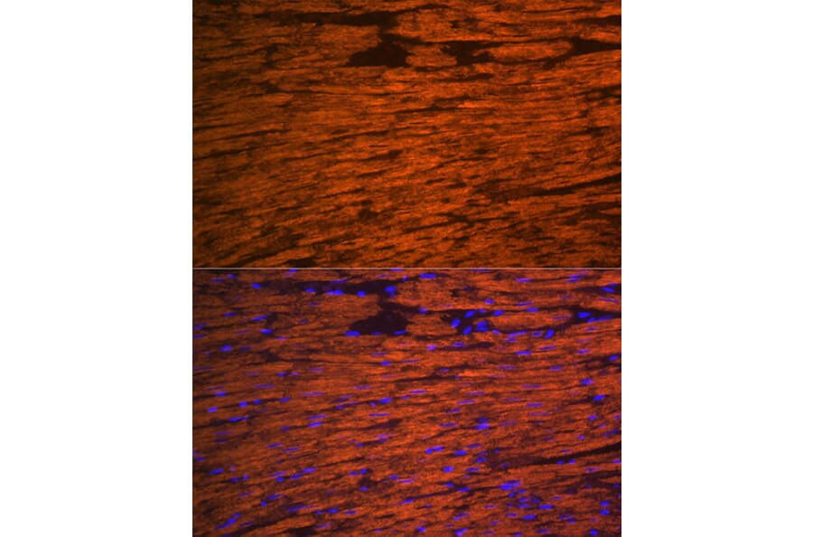 Immunofluorescence - Anti-Myosin Light Chain 2 Antibody (A88648) - Antibodies.com